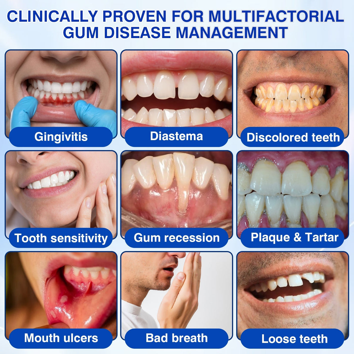 🔥Last Day 49% OFF 🔥Purelora® GumRevive Periodontal Repair Gel