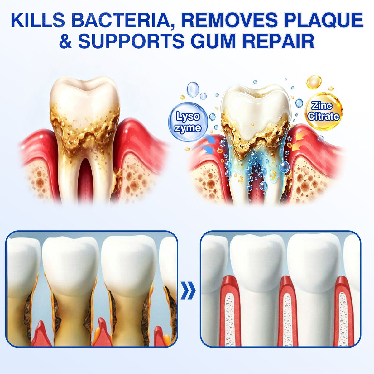 🔥Last Day 49% OFF 🔥Purelora® GumRevive Periodontal Repair Gel