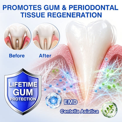 🔥Last Day 49% OFF 🔥Purelora® GumRevive Periodontal Repair Gel