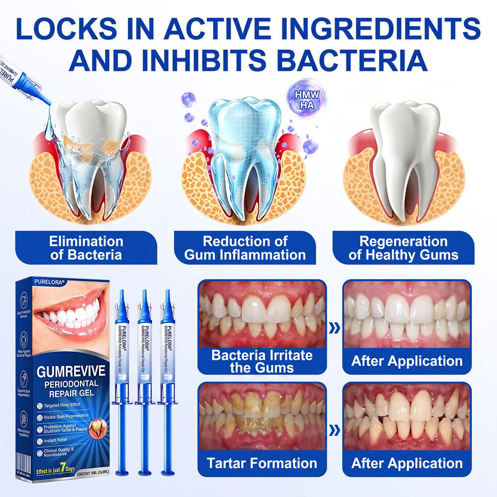 🔥Last Day 49% OFF 🔥Purelora® GumRevive Periodontal Repair Gel